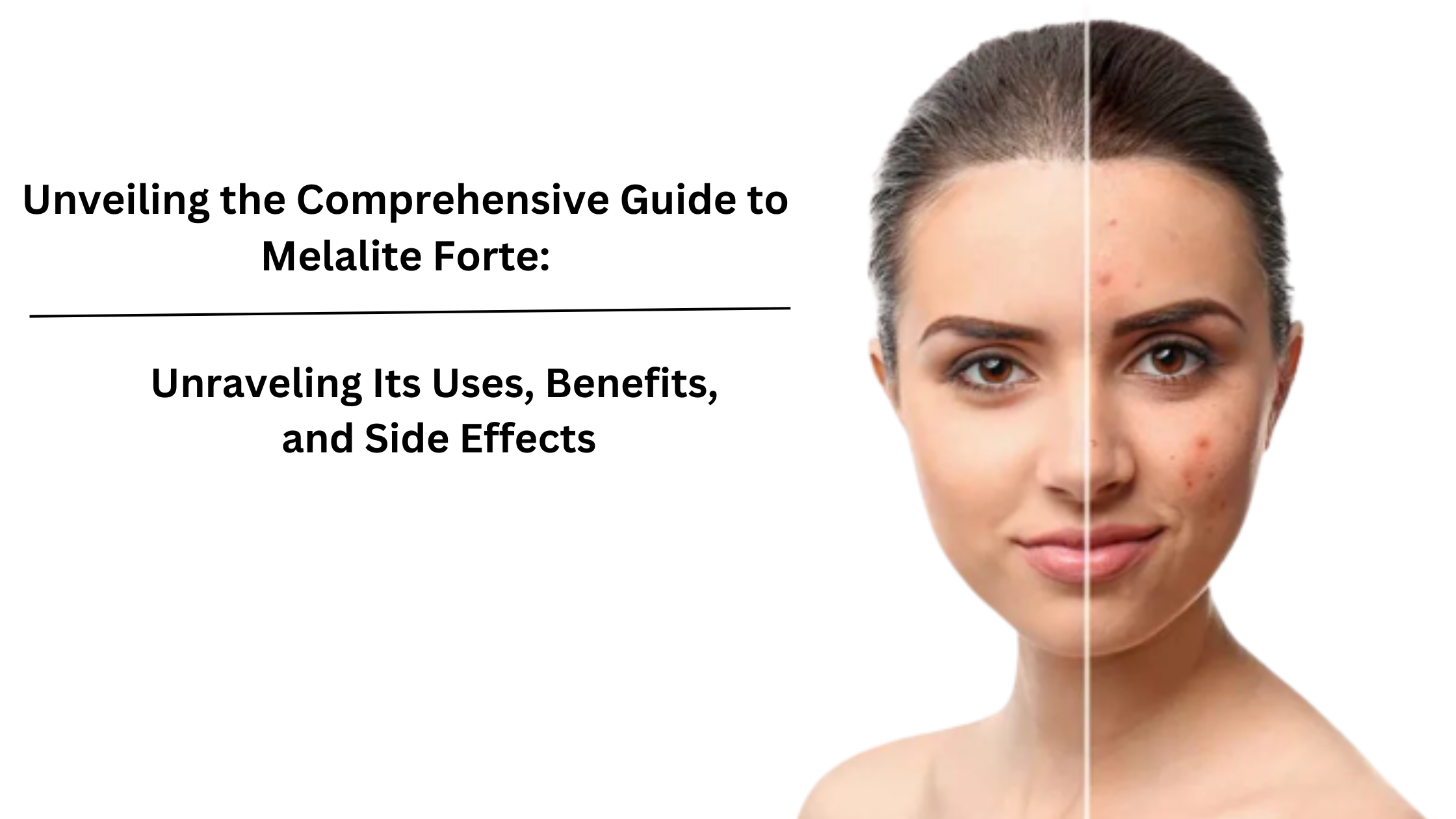 Unveiling the Comprehensive Guide to Melalite Forte: Unraveling Its Uses, Benefits, and Side Effects