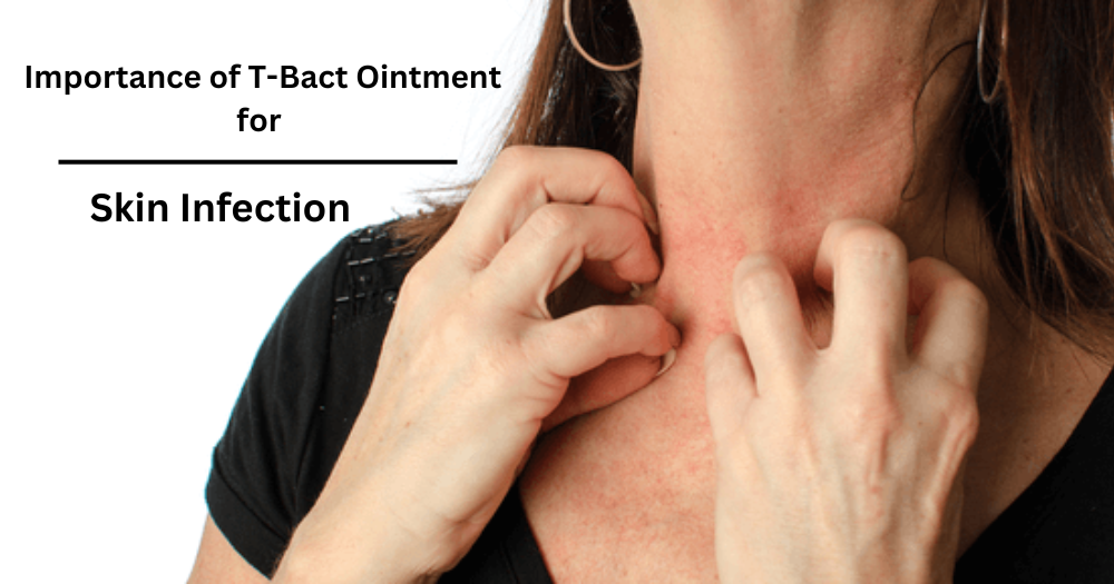 Importance of T-Bact Ointment for Skin Infection