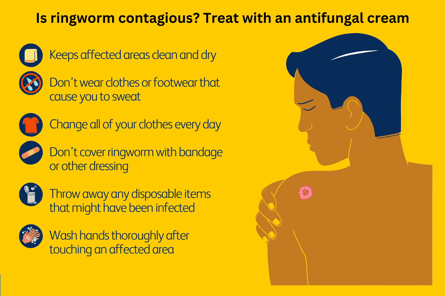 Is ringworm contagious? Treat with an antifungal cream