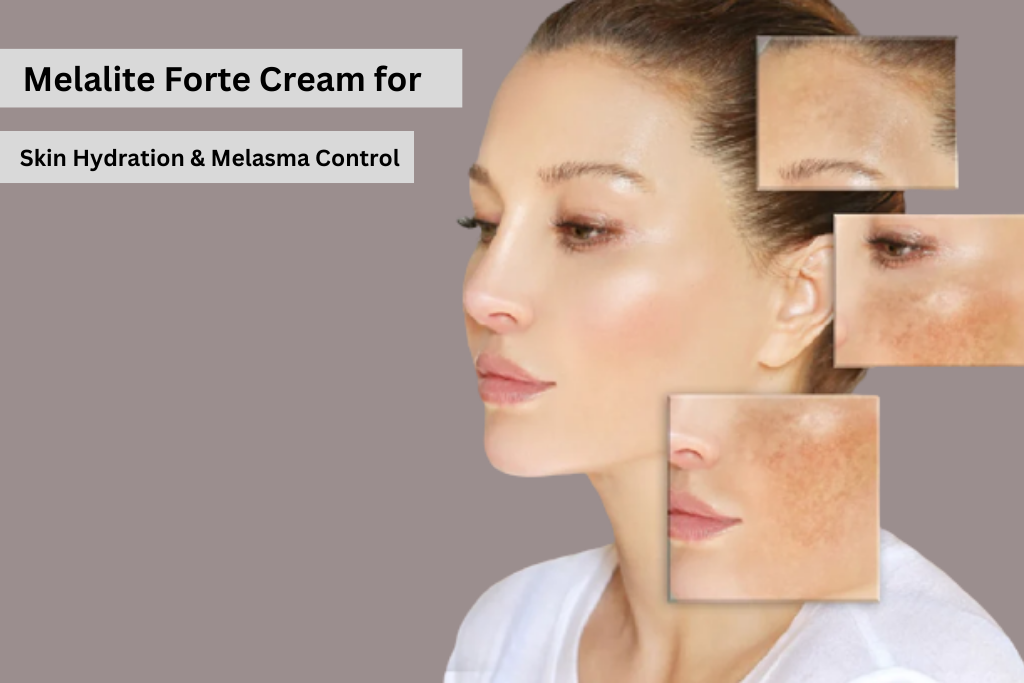 Melalite Forte Cream for Skin Hydration & Melasma Control